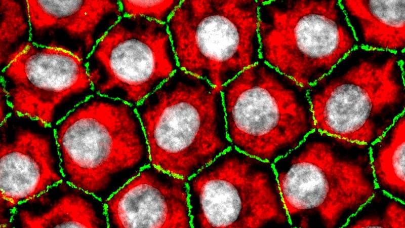 Corneal endothelial cells have a honeycomb structure. [credits: Zinguo.he/Wikimedia]