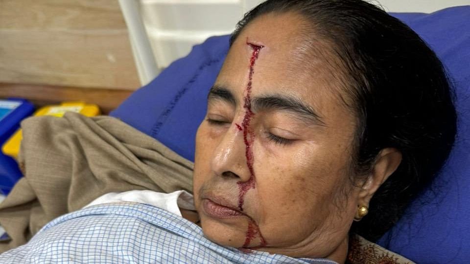 <div class="paragraphs"><p>West Bengal Chief Minister Mamata Banerjee at the SSKM Hospital in Kolkata after suffering a head injury.</p></div>