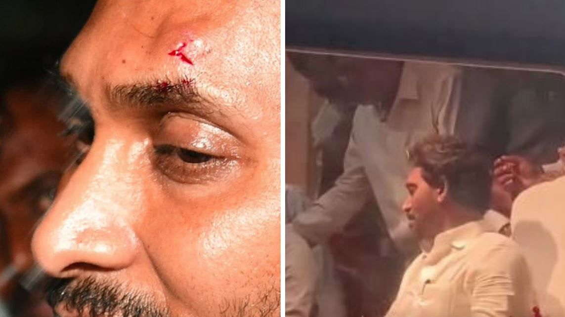 <div class="paragraphs"><p>Close-up of injury (L) and&nbsp;Jagan Mohan Reddy getting first aid after being injured&nbsp;during Vijayawada road show</p></div>