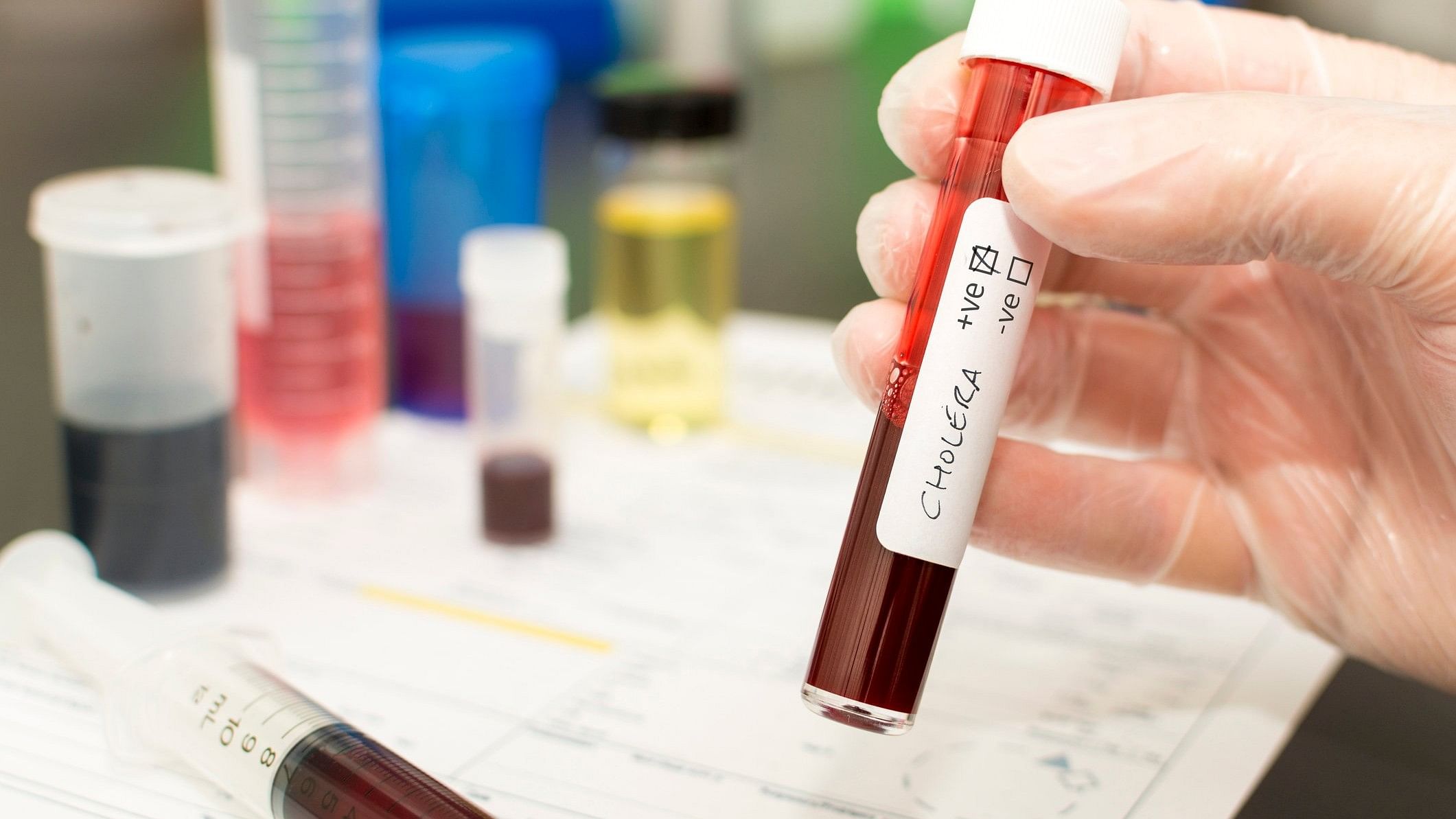 <div class="paragraphs"><p>Representative image of a blood sample in test tube with cholera written on it.&nbsp;</p></div>