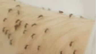 <div class="paragraphs"><p>A screengrab from video showing numerous mosquitoes on Dr Ross' arm.</p></div>