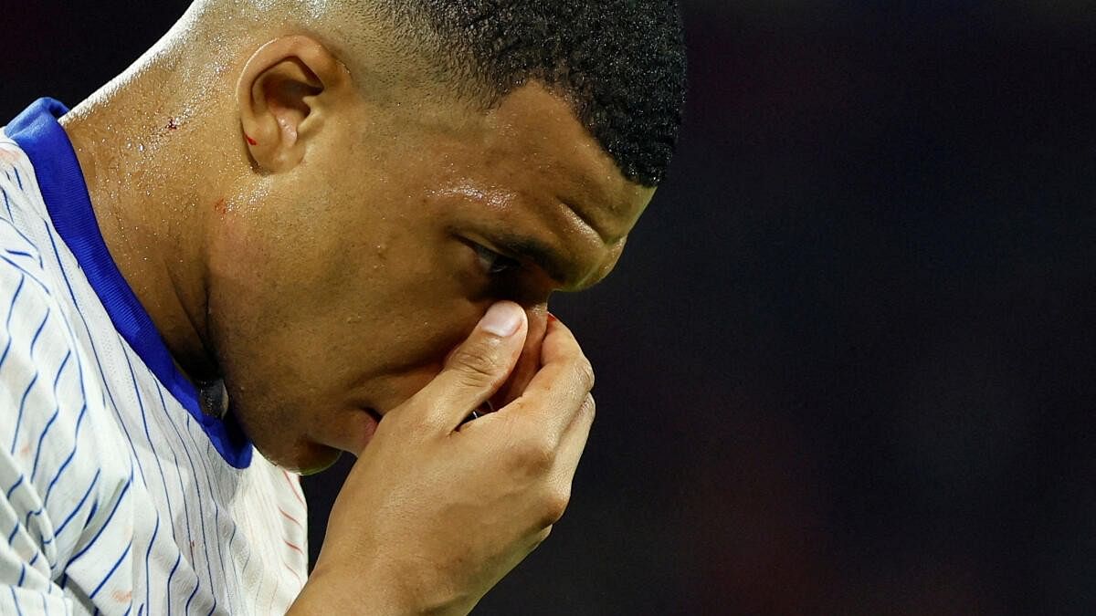 <div class="paragraphs"><p>France's Kylian Mbappe holds his face after sustaining a facial injury.</p></div>