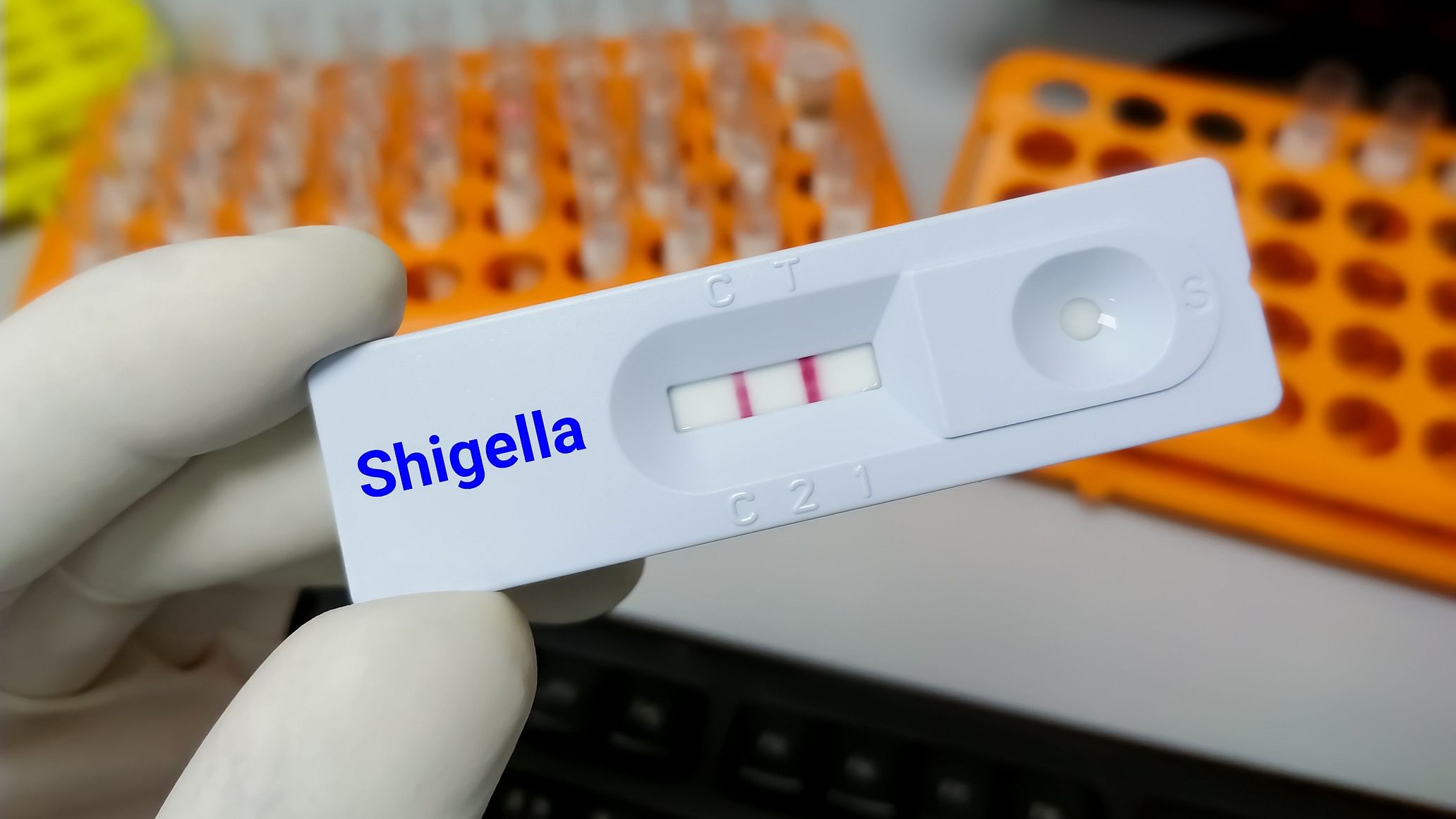 <div class="paragraphs"><p>Rapid test cassette for Shigella infection.</p></div>