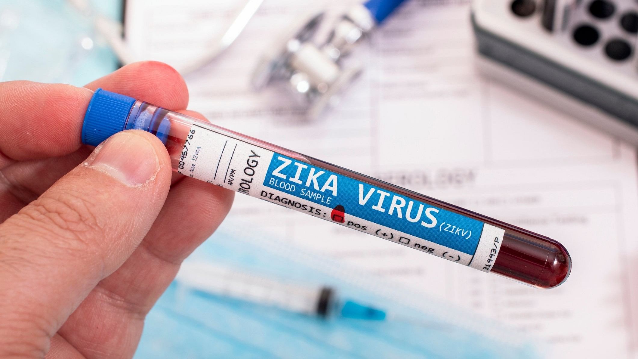 <div class="paragraphs"><p>Zika virus infection is dangerous for pregnant women and prospective parents. Image for representation.</p></div>