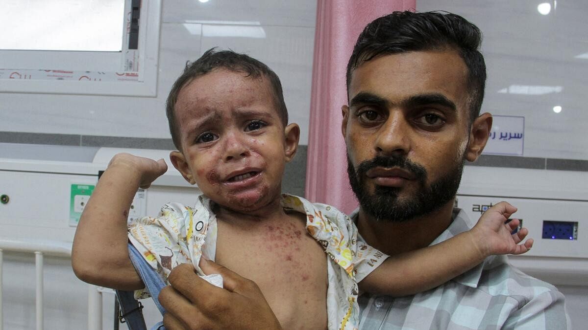 <div class="paragraphs"><p>Skin diseases worsen the plight of Gazans as war drags on</p><p></p></div>