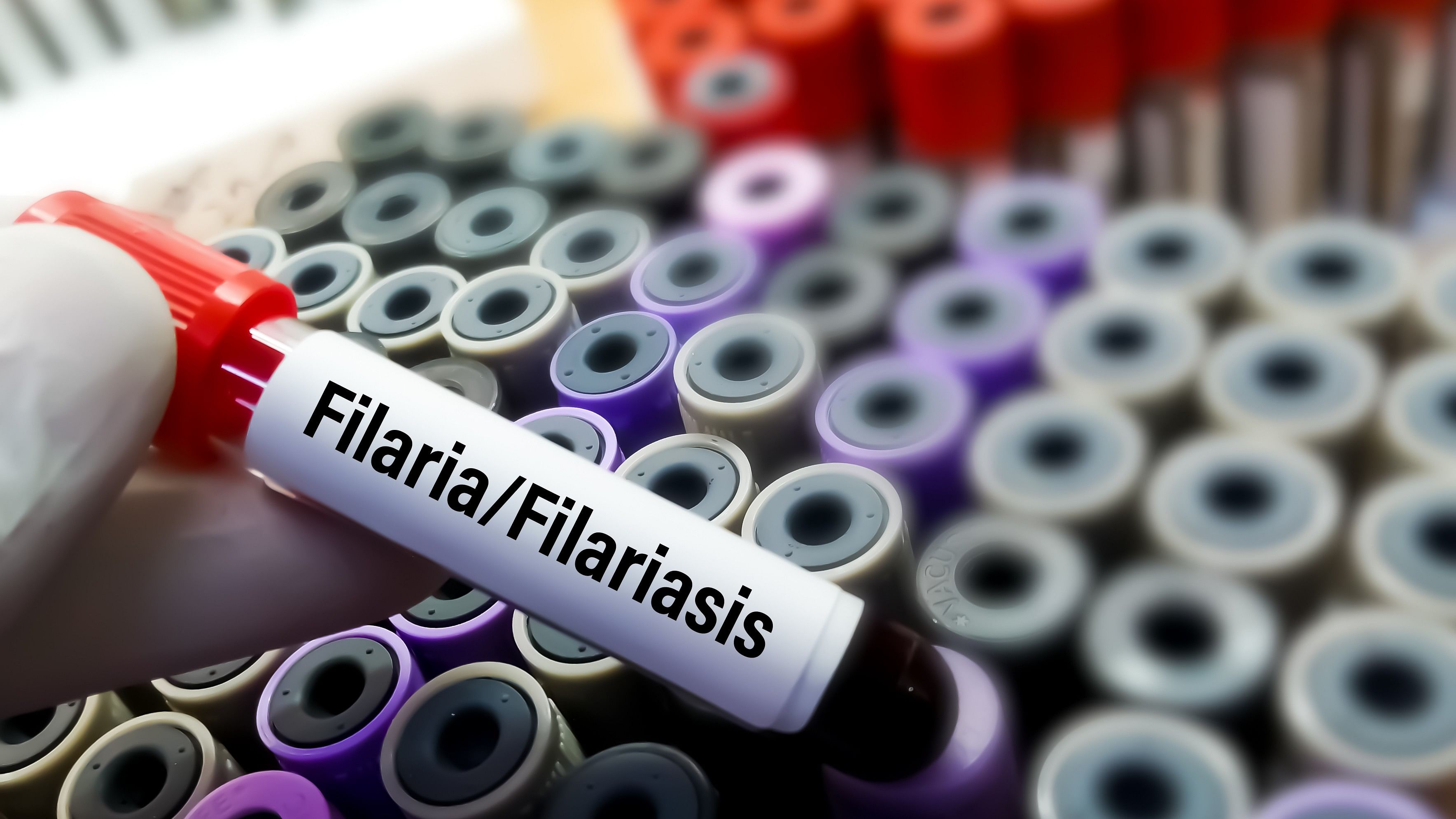 <div class="paragraphs"><p>Representative image of a&nbsp;filariasis test.&nbsp;</p></div>