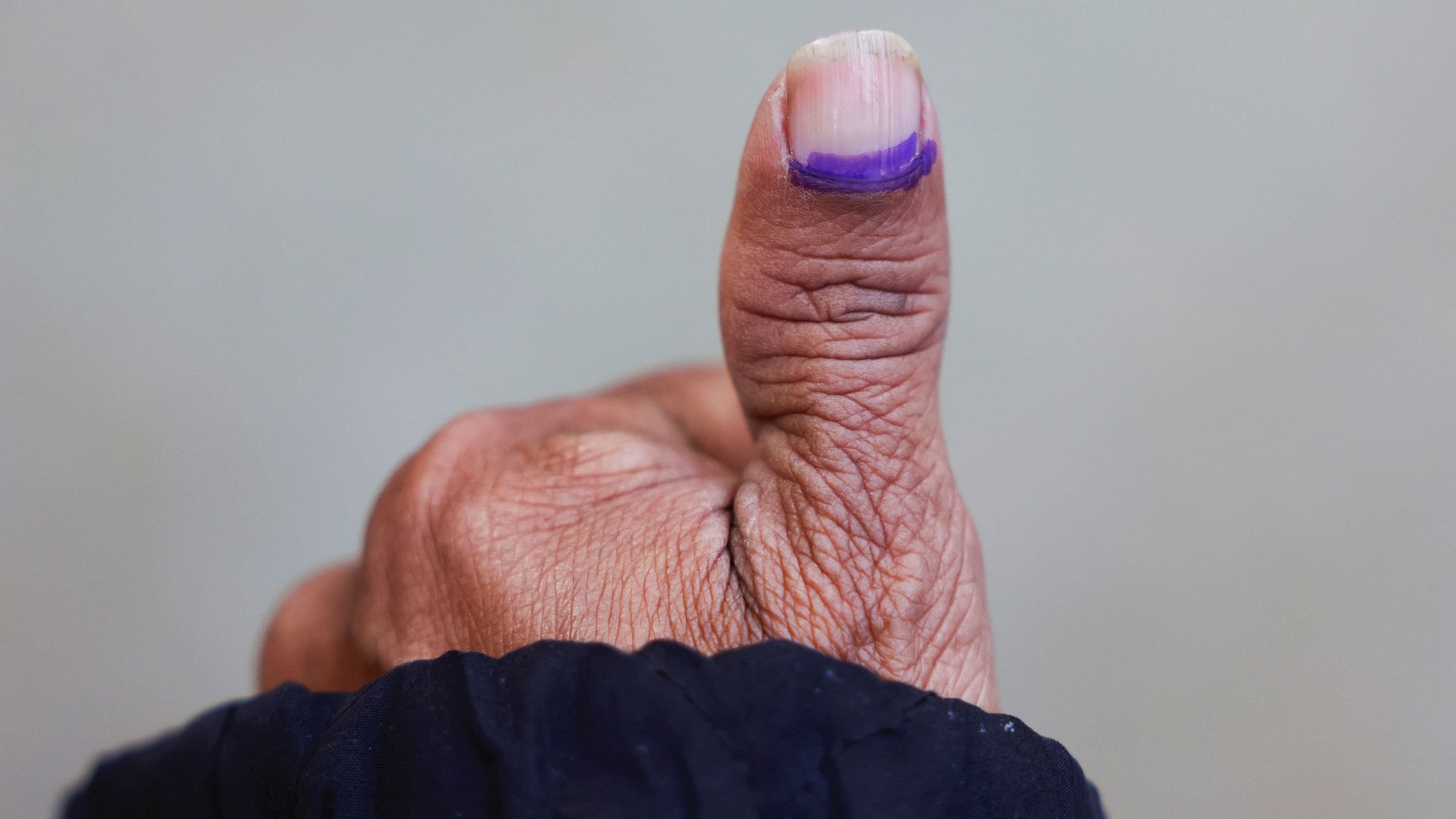 <div class="paragraphs"><p>An elderly man's thumb, Representative image.</p></div>