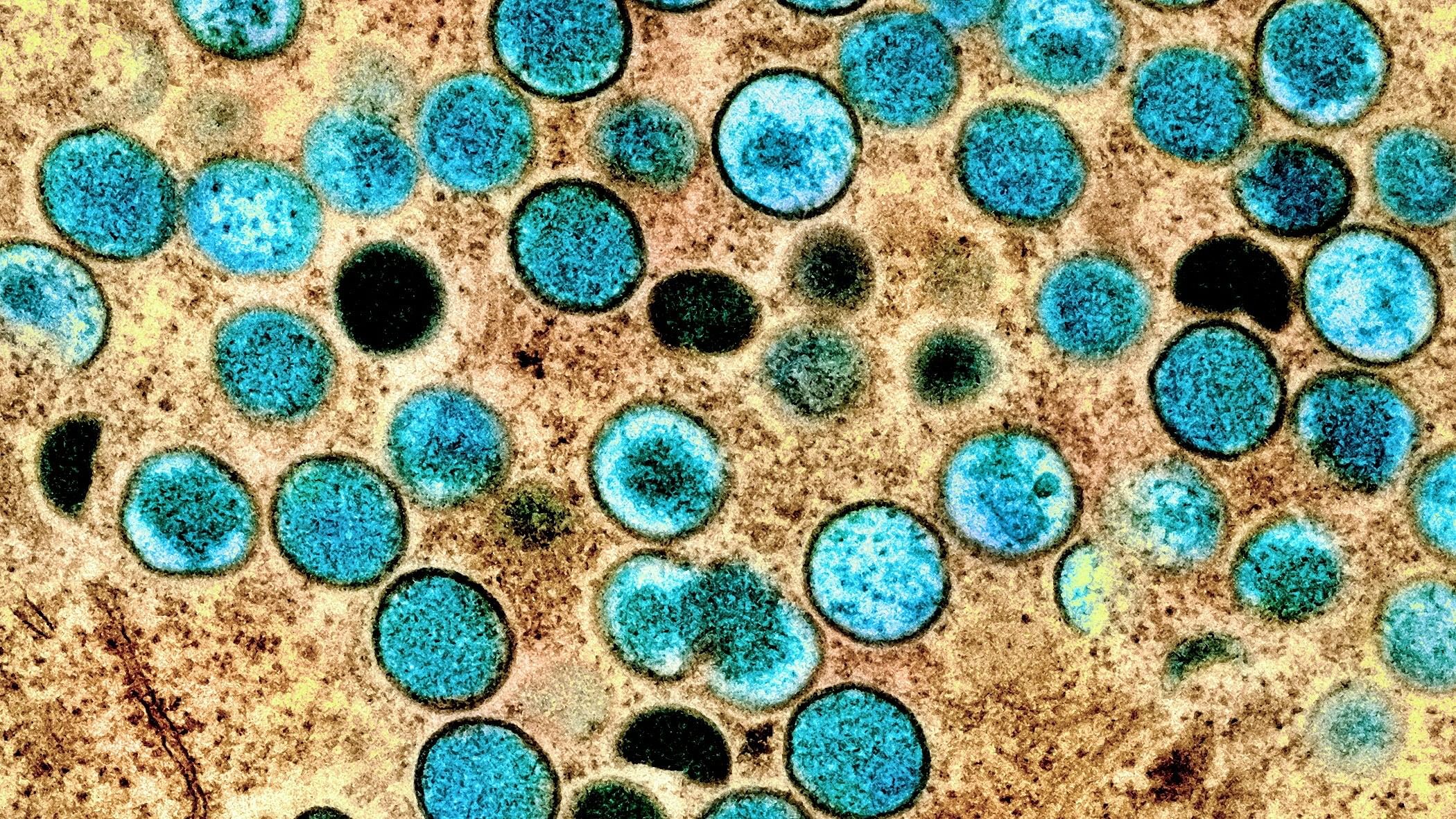 <div class="paragraphs"><p>An undated colorized transmission electron micrograph of mpox virus particles  in Fort Detrick, Maryland.    </p></div>