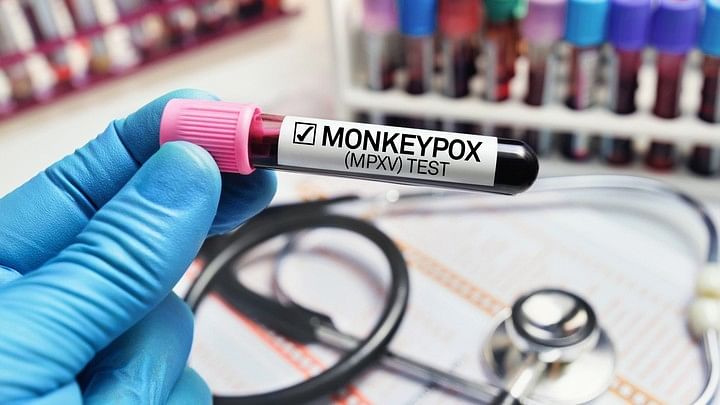 <div class="paragraphs"><p>Authorities in Pakistan on Monday reported a suspected case of Monkeypox (mpox) in Pakistan-occupied Kashmir, taking the number of people affected by the virus to four.</p></div>