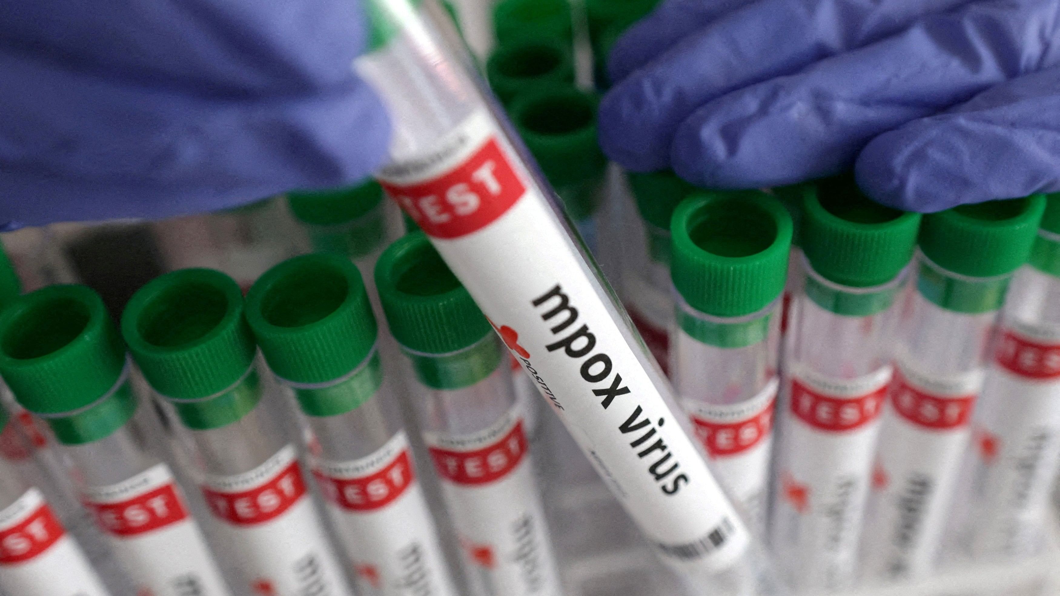 <div class="paragraphs"><p>FILE PHOTO: A test tube labelled 'Mpox virus positive'.</p></div>