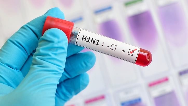 <div class="paragraphs"><p>Blood sample with H1N1virus.</p></div>