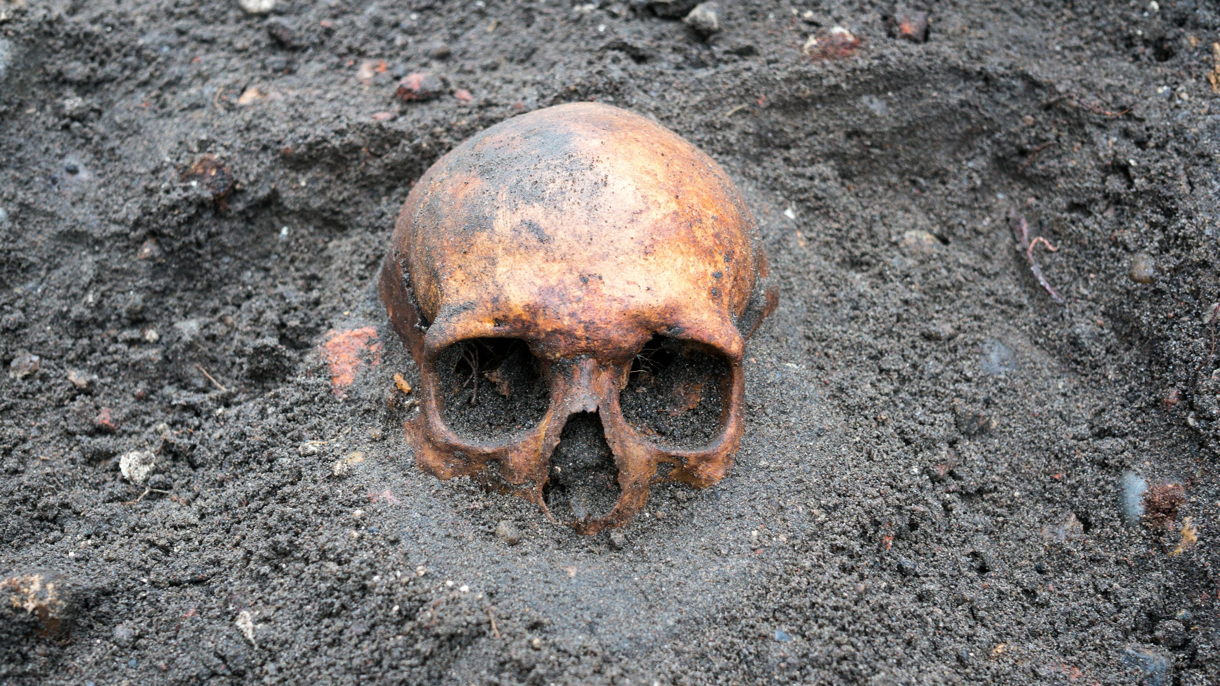 <div class="paragraphs"><p>Representative image showing a skull.</p></div>