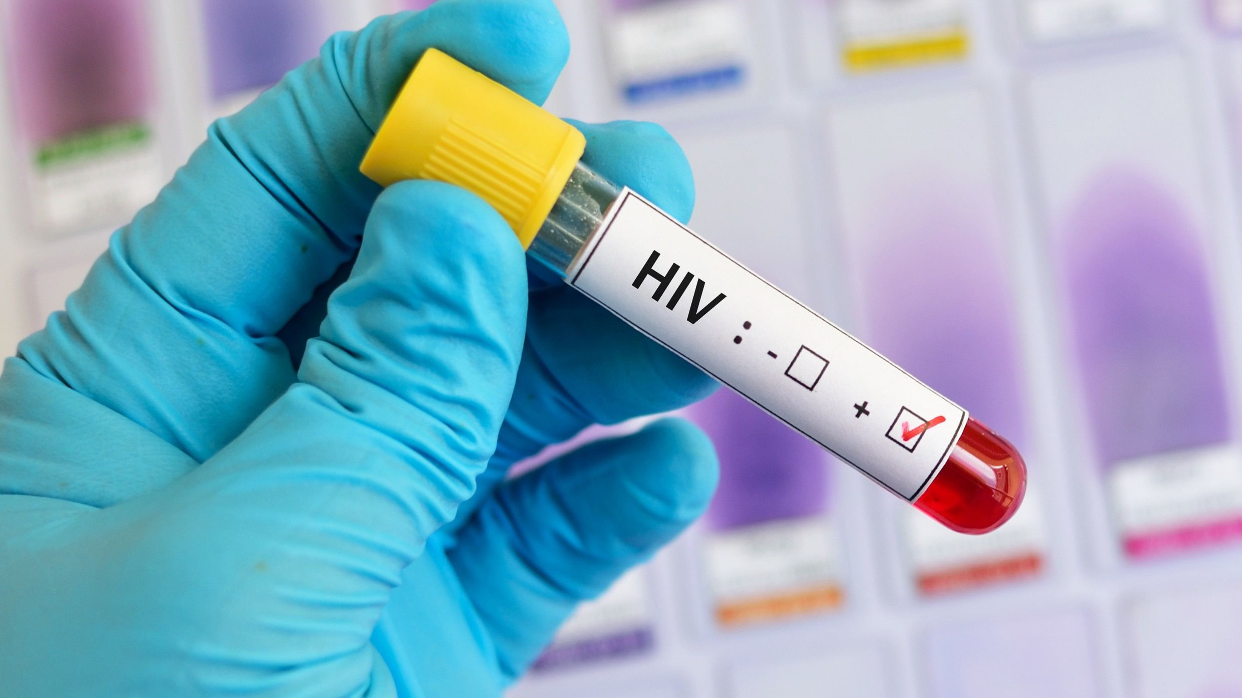 <div class="paragraphs"><p>Representative image shows a blood vial with HIV positive marked</p></div>