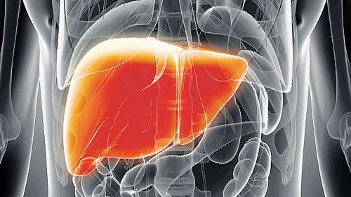 <div class="paragraphs"><p>Fatty liver disease</p></div>