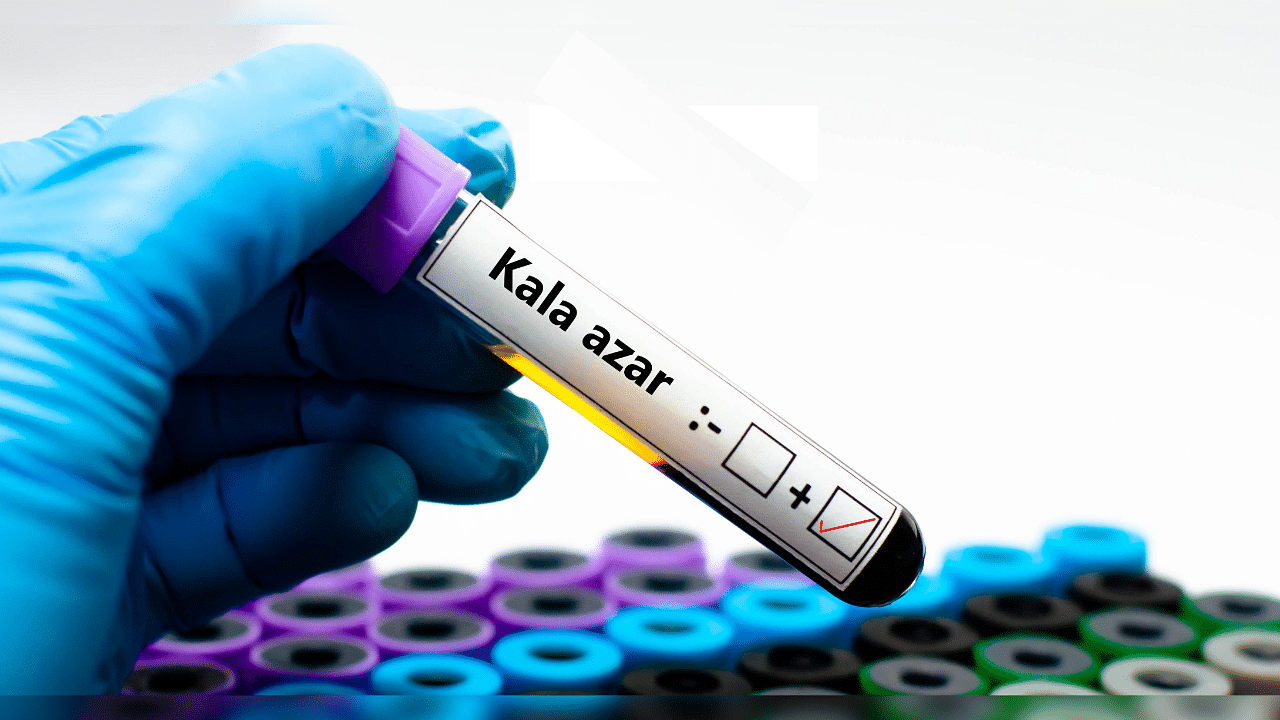 <div class="paragraphs"><p>Representative image showing a test tube with blood marked positive for 'Kala-azar'</p></div>