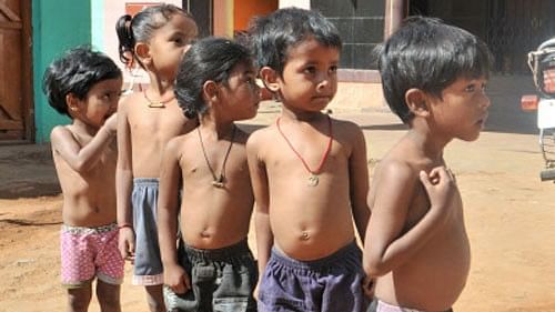 <div class="paragraphs"><p>Representative image of malnourished children.   </p></div>