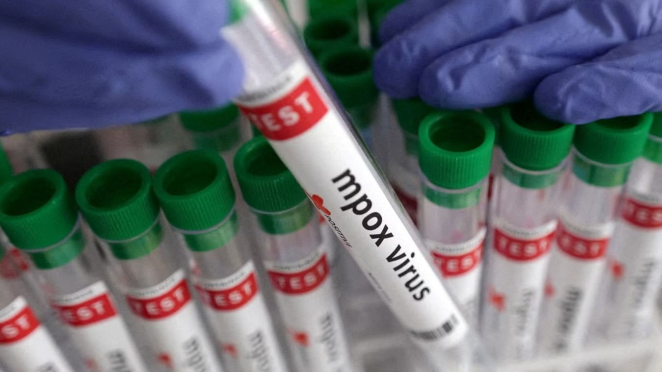 <div class="paragraphs"><p>A test tube labelled 'Mpox virus positive' is held (Representative Image).</p></div>