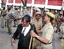 A policeman detains a bleeding lawyer during a clash between lawyers and police outside the High Court in Chennai on February 19. AP