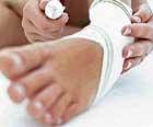 Treating athlete's foot