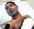 Umar Farooq, one of the lucky survivors of Air India aircraft crash, speaking in hospital at Mangalore on Saturday. AP