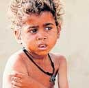 Ram Prasad, 6, who suffers from malnutrition, is seen at Balabehat village in Lalitpur district, Uttar Pradesh. Reuters