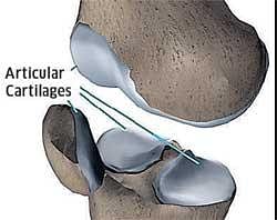 Knee cartilage