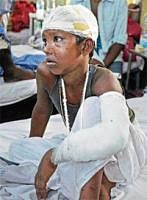 Asraful, a victim of Mondays train accident, undergoes treatment at a hospital in Birbhum in  West Bengal on Tuesday. PTI