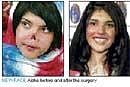 Poster girl of Taliban oppression gets new nose