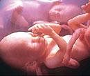 Progressive India bays for unborn girls' blood