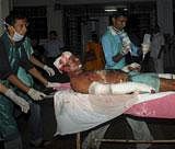An injured victim of blast being rushed to a hospital in Mumbai on Wednesday. PTI