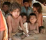Malnutrition a matter of national shame: PM