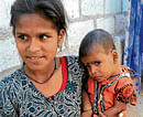 Ashwini carries her malnourished sister Divyashree at an anganwadi centre in Chiksugur village in Raichur district. DH Photo