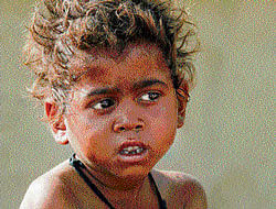 State govt begins identifying malnourished children