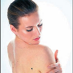 New treatment target for melanoma skin cancer discovered