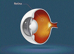 LIGHT SENSITIVE: When the retina is affected, vision is consequently affected, and can be restored only when the retinal cells are restored. (getty images)