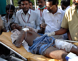 An injured person is rushed for treatment after a massive blaze swept through the Om Siva Shakti fireworks factory in Sivakasi, about 650 kilometers (400 miles) southwest of Chennai, India, Wednesday, Sept.5, 2012. Large amounts of firecrackers and raw materials were stored in the factory with major Hindu festivals weeks away. Dozens of workers were killed and dozens were injured in the fire, the cause of which was not immediately known.AP