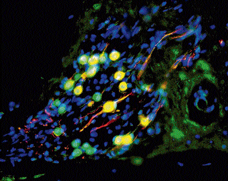 Human stem cell-derived otic neurons repopulating the cochlea of deaf gerbils are seen in this undated handout photo courtesy of the University of Sheffield. Reuters