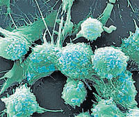 Now, magnets that force cancer cells to 'commit suicide'