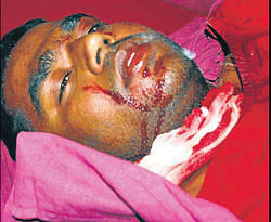 Auto driver Santhosh in a hospital in Hassan. dh photo