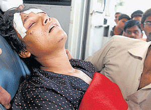 Volleyball player Arunima Sinha after she was trown off a train in 2011.