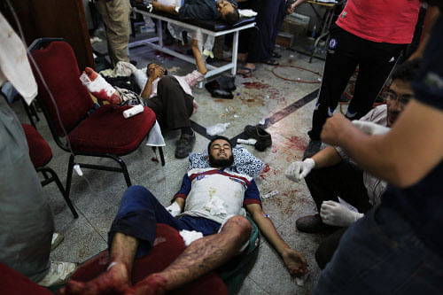 A wounded supporter of Egypt's ousted President Mohammed Morsi receives treatment at a local hospital in Cairo, Egypt, Monday, July 8, 2013. Egyptian soldiers and police guarding the Republican Guard building opened fire on supporters of the ousted president Monday in bloodshed that claimed dozens lives, officials and witnesses said, and plunged the divided country deeper into crisis with calls by Islamists for all-out rebellion against the army. (AP Phot)