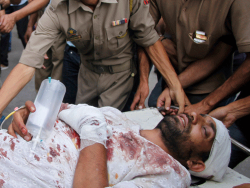 A villager who was injured after being shot by Indian Border Security Force soldiers is brought for treatment at the government medical college hospital in Jammu, India, Thursday, July 18, 2013. Government forces in the Indian portion of Kashmir on Thursday fatally shot four villagers and wounded 25 others who were protesting the alleged desecration of the Muslim holy book by border guards, police said. (AP Photo/Channi Anand)
