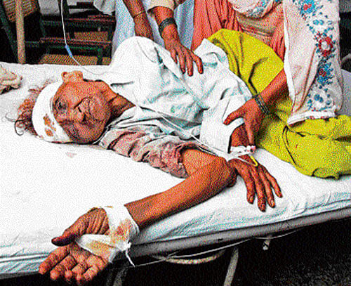 Shakuran, 70,  injured in the communal riots, receives treatment at  Government Hospital in Muzaffarnagar on Tuesday. PTI