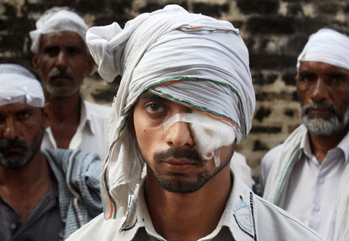 Villagers who were injured in communal riots at Kakda, near Shahpur in Muzaffarnagar on Tuesday. PTI Photo