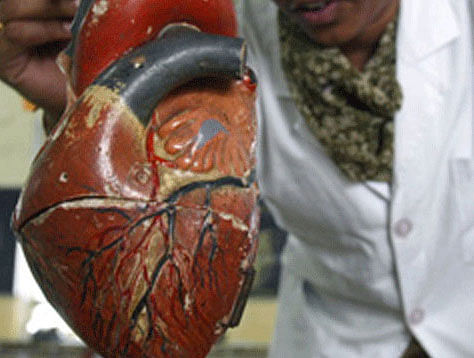 Chennai docs perform smallest artificial heart transplant