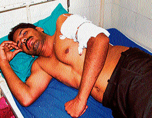 Yogesh, injured in a leopard attack, being treated at the Government Hospital, in Hassan, on Wednesday. DH Photo