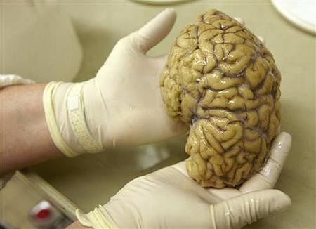 A 21-year-old man has been arrested in the US for allegedly stealing brains of dead mental patients from a medical history museum and selling them on an online trading website. Reuters file photo for representation only