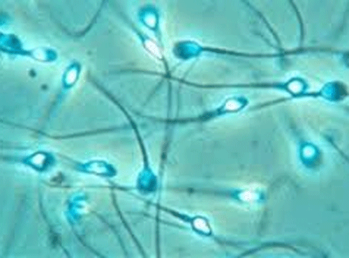 Apart from their natural act, sperms are set to be used as biological motors for transporting drugs, genes and other sperms to help treat infertility and other issues. Reuters file photo for representation only