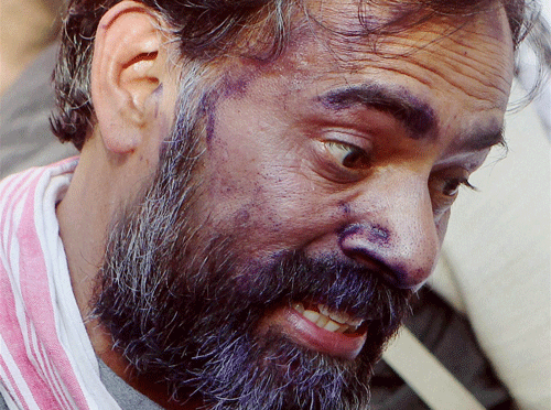 AAP leader Yogendra Yadav talking to the media after his face was smeared with ink by a youth during an event at Jantar Mantar in New Delhi on Saturday. PTI Photo