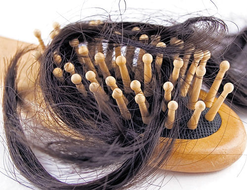 A common side-effect of cancer treatment is hair loss, DH photo